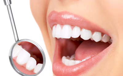 The Importance of Regular Dental Cleanings by a Professional Dental Hygienist